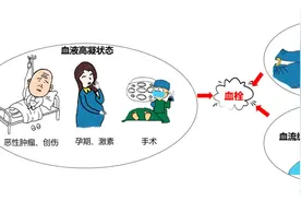 坐月子期间不活动，当心招惹“要命”血栓！图片