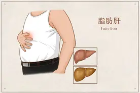脂肪肝患者如何合理饮食图片