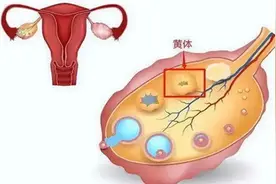女性突发剧烈腹痛，当心黄体破裂图片