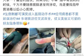 今天一个热搜，很多网友惊呼再也不敢了！女子因拔倒刺要刮骨手术，曾有人失去一根手指……图片