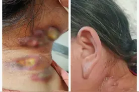 “她这么困难，不能让她花钱！”——枣庄市胸科医院有这样一位“拒绝”患者的医生图片