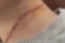 连发多起！有人惨遭“割喉”图片