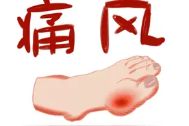 已进入高发期！痛风正在加重的3个信号要知道，这些食物都少吃！图片