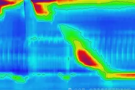 【垂医科普】消化内科：不明原因胸痛、吞咽困难、呕吐，胃镜却未见异常怎么办图片