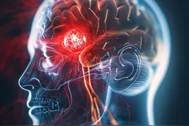 中国脑健康月｜磁共振检查报告“腔隙性脑梗死”，严重吗？图片