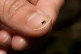 小心！成都一男子户外踏青时被蜱虫叮咬后高烧不止、腹泻呕吐，急诊医生提醒→图片