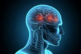 体检有“缺血灶”是大脑缺血了？有“腔梗灶”是得了脑梗死？｜世界卒中日图片
