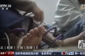 “腿喷脓了，挤也挤不完”，女子出国做手术断骨增高，右腿感染严重图片