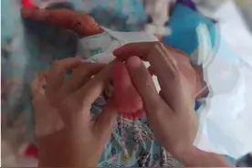 出生时不足3斤！这家医院成功救治极低体重早产儿图片