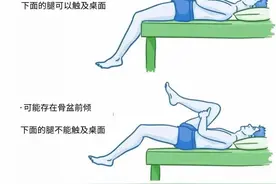 别再焦虑了！你可能根本不是“骨盆前倾”！图片