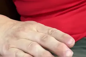 周鸿祎回应被车门夹手：恢复得差不多了，车挺让我满意的图片