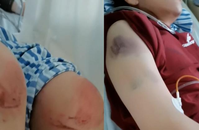 “女子遭家暴逃跑致丈夫身亡案”二审将开庭，当事人父亲：女儿才是受害者	，是正当防卫