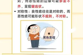 “医”图读懂｜痣，有好坏之分哦！图片