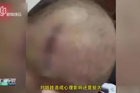 针头遗留男童体内长达5年多 家长：已发现针头位置 但手术风险高