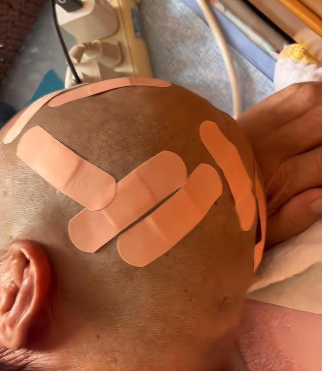 大爷花10元剃头后满头伤口不忍追责