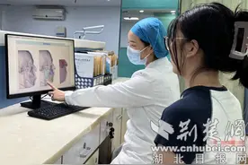 太和医院正畸正颌联合治疗让严重口腔骨性畸形患者重拾微笑图片