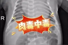 52天宝宝中毒进ICU，因奶奶往水里加了点蜂蜜图片