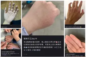 撑起近15000家瑞幸的背后：咖啡师的“烂手”之痛图片