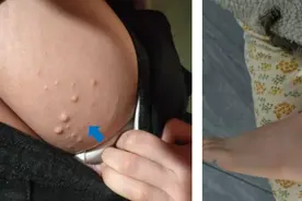 台州2岁宝宝不幸确诊！竟和这个习惯有关……图片