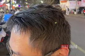 晚上在外吃夜宵时秒变“爆炸头”？真相来了！图片