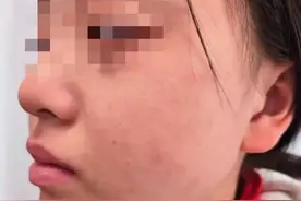 近期高发！女孩西湖边暴走3小时，中招了！会持续到5月……图片