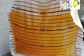 血里榨出几袋“油”！90后小伙急需血透……这习惯很多人都有图片