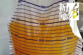 血里榨出几袋“油”！90后小伙急需血透……这习惯很多人都有图片