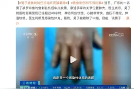 女子被梭子蟹扎伤进ICU，为啥这么严重？图片