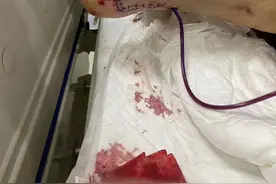 法治面 | 民警与嫌犯搏斗摔伤，应认定“公伤”还是“工伤”？图片