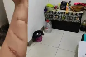 女子为保护室友被其前男友砍20多刀！“他们的冷漠让我寒心”图片