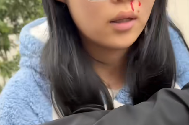 女子称目击邻居牵绳遛狗被一家人围殴，帮忙作证也被打伤	，打人男子还扬言要杀狗……警方通报：已依法行政立案