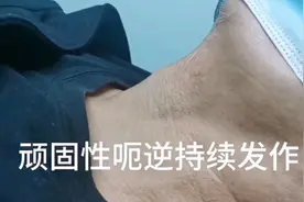 治疗“打嗝”新方法！神经阻滞术治愈一例顽固性呃逆患者图片