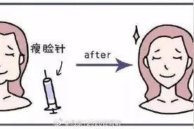 注射肉毒素的注意事项图片