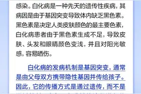 白化病是种传染病、一旦接触患者就会被感染？图片