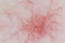 身上发痒一查竟是肝癌？4种表现当心是肝脏求救信号图片