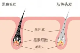 头发白了，还能变黑吗？医生的答案出乎意料图片