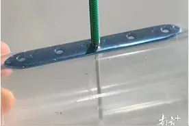 新兴县人民医院骨膜牵张术让“糖足”患者免遭一“截”图片