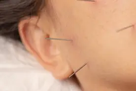 知名女星晒照引热议！脸上密密麻麻……图片