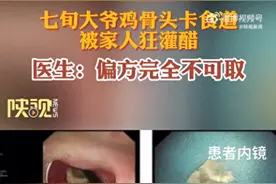 七旬大爷鸡骨头卡喉被家人狂灌醋，医生这样提醒图片