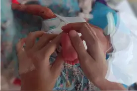 出生时不足3斤！济南市第三人民医院成功救治极低体重早产儿图片