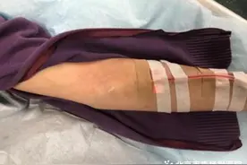 【垂医科普】肾内科：肾友冬日自我防护攻略（一）衣食住行篇图片