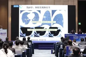 专家：只有10%的肺小结节是恶性，如何找出它们非常重要图片