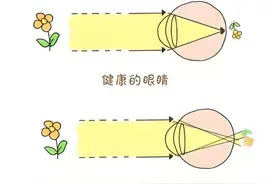 有散光怎么办？这篇教你看懂散光→图片