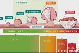 【垂医科普】消化内科：发现肠癌要及早图片