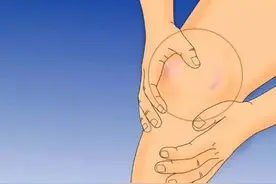 驻马店魏道德骨科医院：应对膝盖肿胀，我们应该怎么做？图片