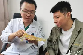 这类人群注意了！大拇指根部疼痛、出现“咔嗒”弹响可能是腱鞘炎图片