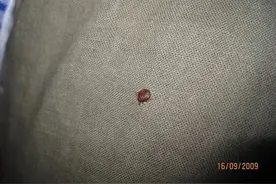 多国爆发床虱危机，皮肤科专家：床虱不传播疾病，但较难彻底消杀图片