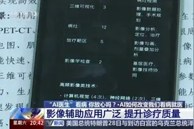 “AI医生”看病 你放心吗？看AI解读AI医疗政策图片