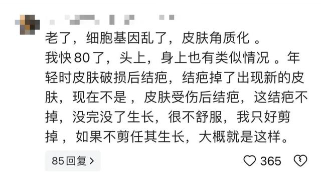 太狠了！上海98岁阿婆拿起剪刀，对准自已一刀下去…后果很严重！