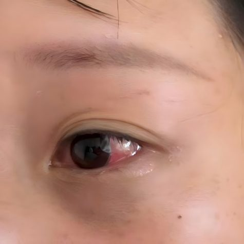 粉色“子弹”飞过来，我的左眼什么都看不清了